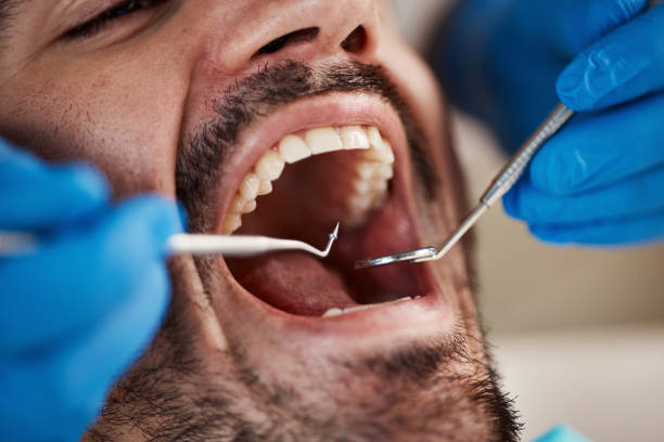 Best Emergency Dental Care for Abscessed Tooth in Dowagiac, MI