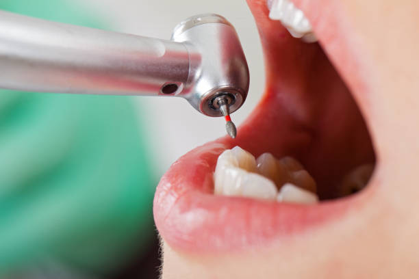 Best Emergency Dentist for Knocked-Out Tooth in Dowagiac, MI
